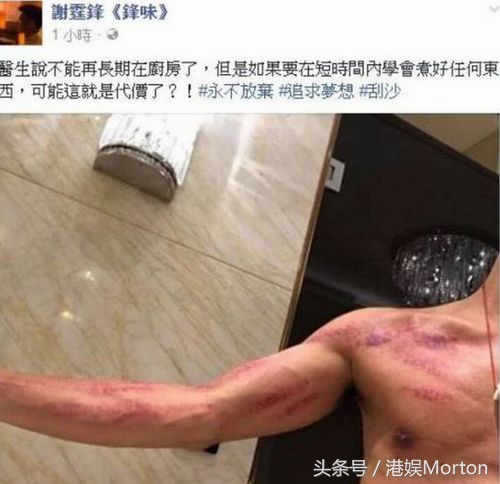 英皇晚宴谢霆锋感谢杨受成,谢霆锋拍男儿本色受伤