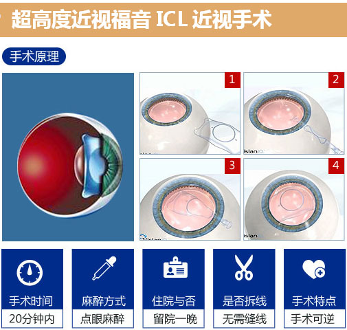 近视眼手术目前有几种方式,做近视眼手术全过程自己知道吗