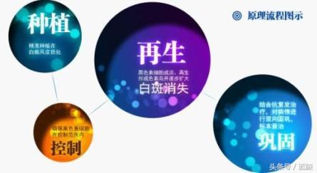 白癜风面积很大怎么办啊,多大面积的白癜风可以植皮