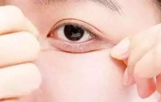 卧蚕眼袋黑眼圈傻傻分不清楚,卧蚕与眼袋别傻傻分不清楚