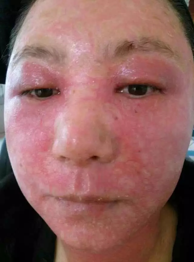 面膜被曝光,面膜里会含有毒品成分吗