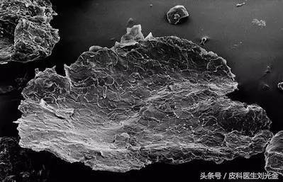 头皮屑多是不是缺少维生素b2,头皮屑多是不是皮肤病