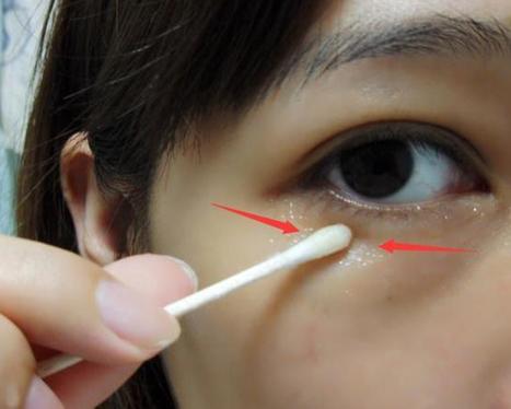 眼袋对形象影响有多大？看看你就都知道了！