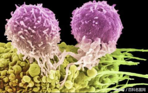 别尴尬!有这些典型症状就是尖锐湿疣了!专家说这样治疗不留疤