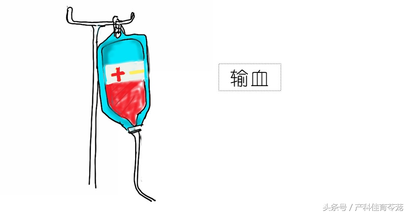 怀孕了有点贫血怎么办,怀孕缺铁性贫血