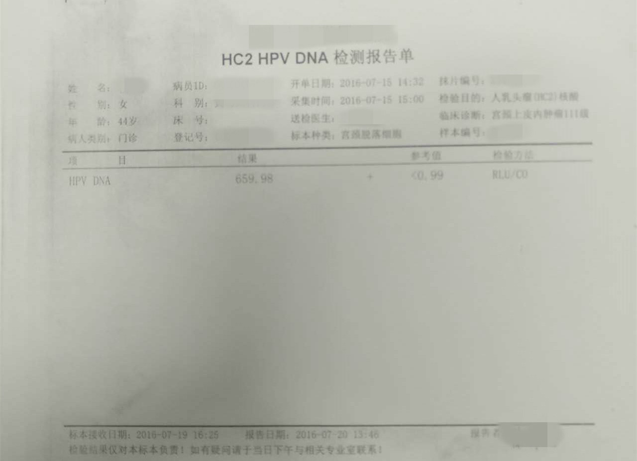 CIN3级累及腺体患者的治疗