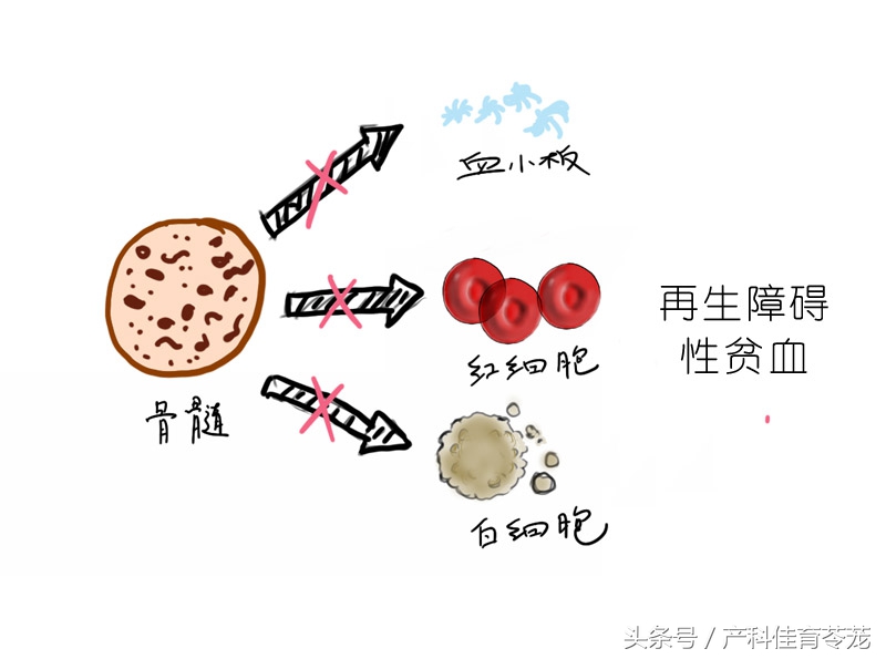 怀孕了有点贫血怎么办,怀孕缺铁性贫血