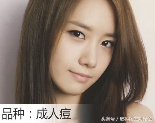 脸上长痘疮的快速解决方法,读懂此文你就可以远离亏损了