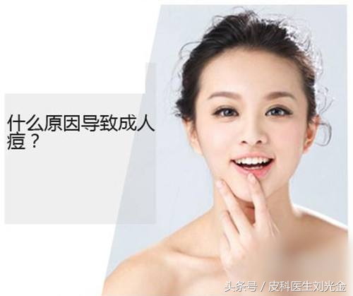 脸上长痘疮的快速解决方法,读懂此文你就可以远离亏损了