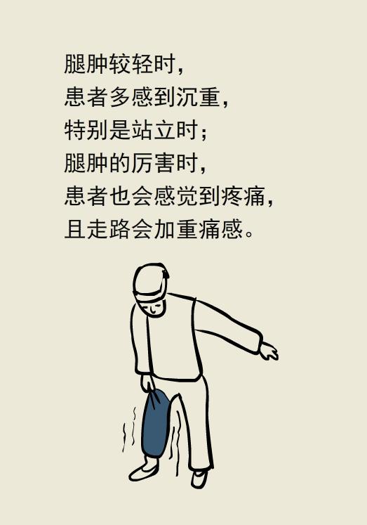 单腿肿和双腿肿的区别,两条腿肿的程度不一样