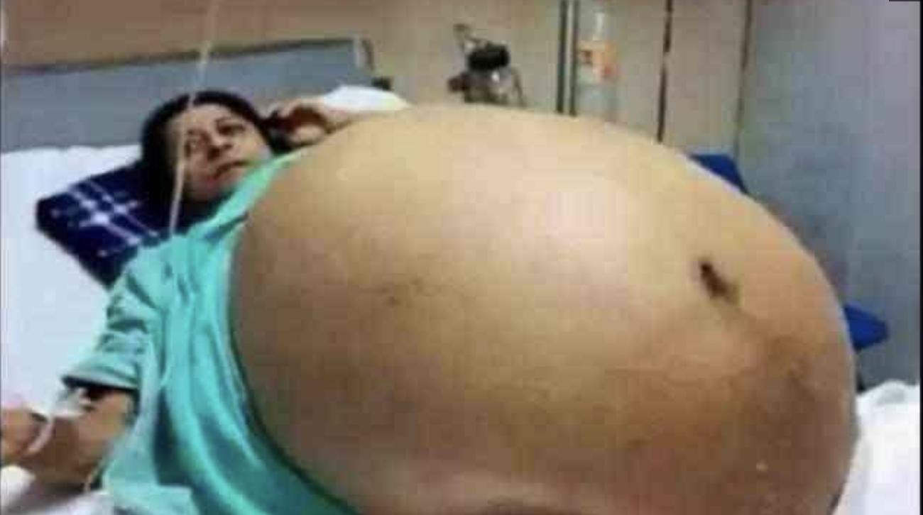 人类一胎能生多少个孩子世界纪录,人类最多能一次生几个孩子