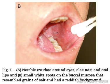 皮肤科普健康知识讲座,皮肤科普视频