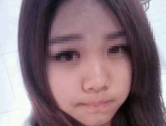 有多少人隆鼻后悔了,隆鼻的十大猫腻