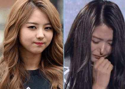 有多少人隆鼻后悔了,隆鼻的十大猫腻