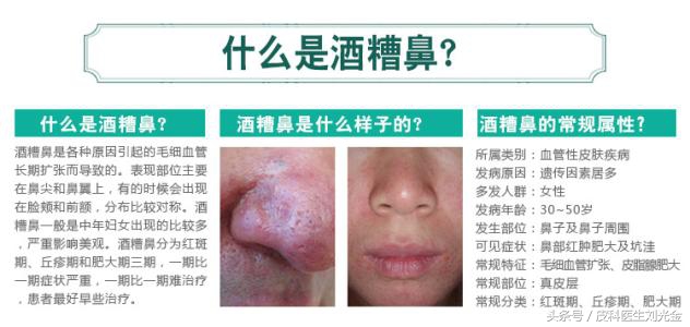 脸上长痘疮的快速解决方法,读懂此文你就可以远离亏损了