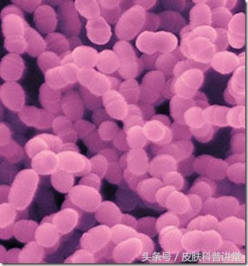一张图教你辨别脓疱疮,皮肤内脓疱疮最快根除方法