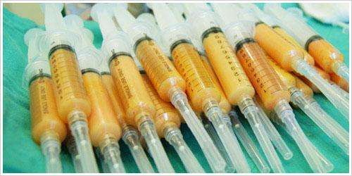 脂肪可以隆鼻么,脂肪隆鼻的最佳方法