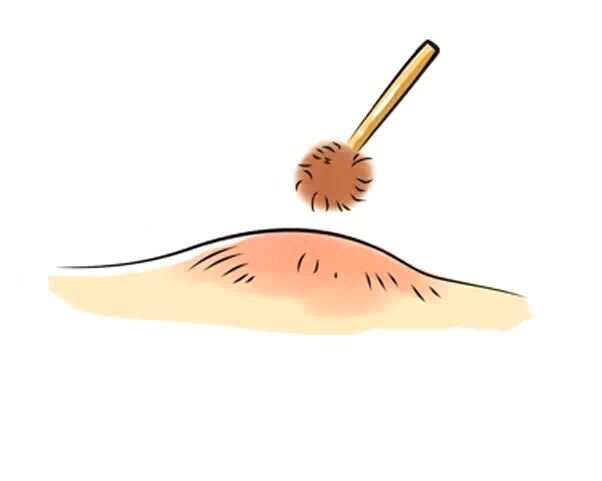 宝宝骨折了如何急救,宝宝骨折恢复过程中的四大禁忌