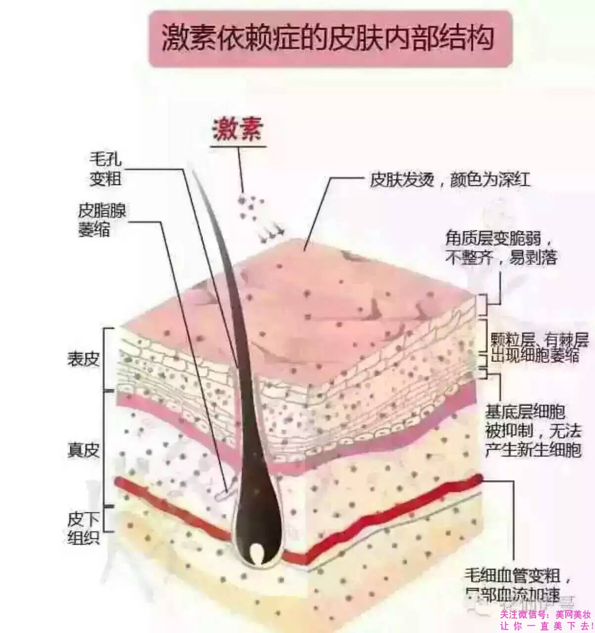 面膜被曝光,面膜里会含有毒品成分吗