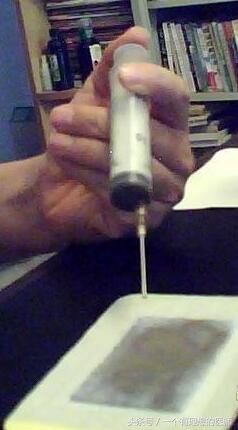 太乙膏药配方与制作方法,医用压敏热熔胶制作膏药