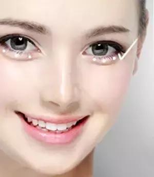 卧蚕眼袋黑眼圈傻傻分不清楚,卧蚕与眼袋别傻傻分不清楚