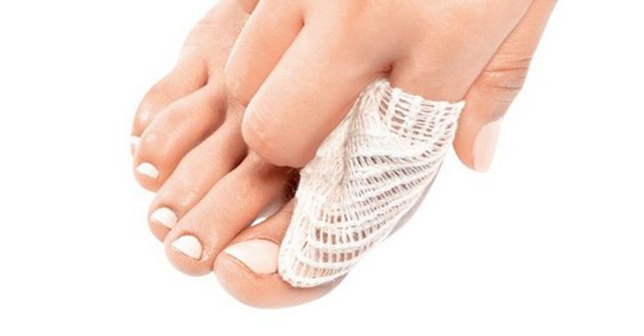 脚趾甲长肉里怎么办最简单的方法,脚趾甲已经长到肉里去了怎么办