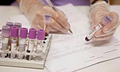 什么是溶血症？什么是ABO溶血？溶血检查些什么？给你所有答案