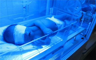 十个新生儿九个患绝症背后真相,新生儿黄疸10个经典问题