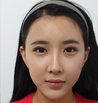 眼袋对形象影响有多大？看看你就都知道了！