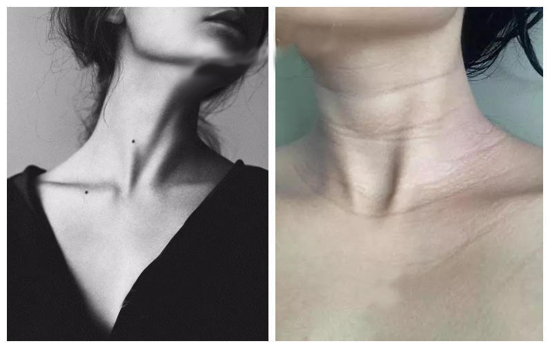 黄金微针祛除颈纹,去除颈纹的微针视频