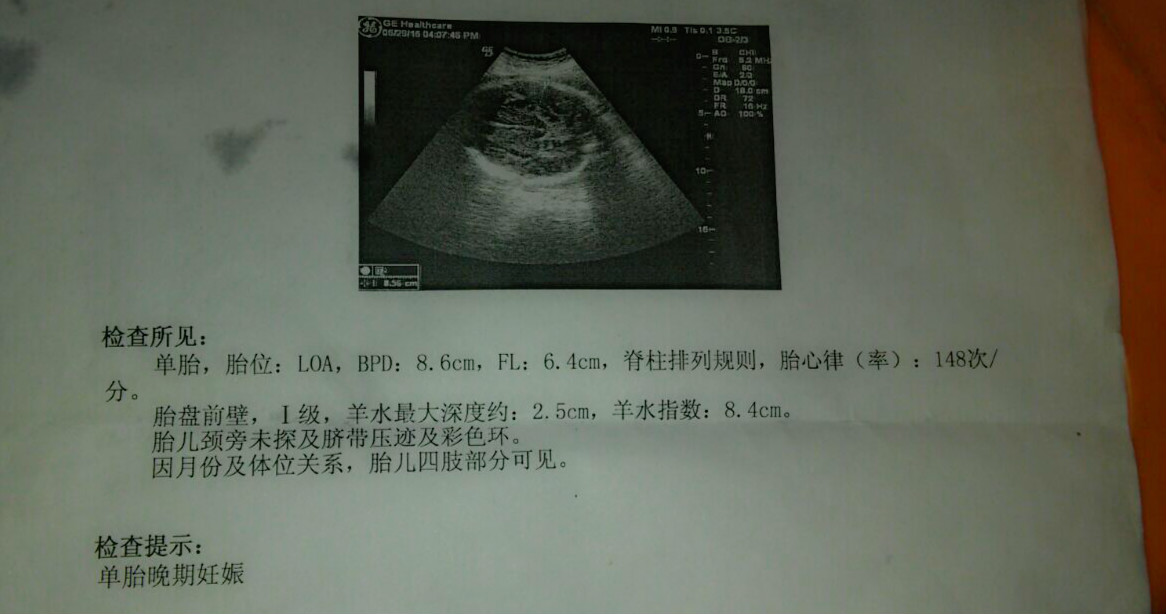 孕36周羊水少是什么原因造成的呢,24周羊水少说明胎儿一定有问题吗