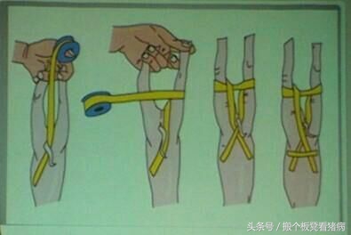 养猪仔猪拉稀技术绝技,仔猪怎么预防猪病