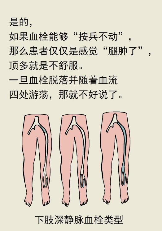 单腿肿和双腿肿的区别,两条腿肿的程度不一样