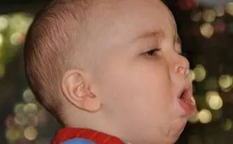 小孩咳嗽的偏方和妙招,专家教你小孩咳嗽小偏方