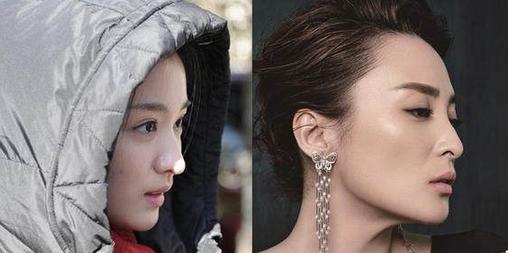 艺考撞脸明星,艺考学生整容