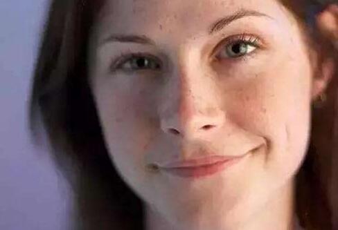 治疗雀斑有效的方法,目前治疗雀斑最有效的方法