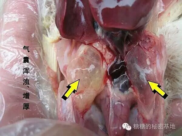 治疗支气管堵塞最好方法,支气管堵塞和气囊炎区别