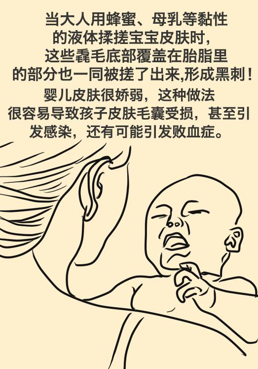 猪毛风在医学上叫什么病,新生儿的猪毛风是什么