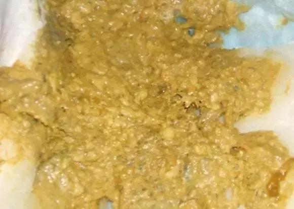 关于宝宝大便的11种性状,宝宝大便6种形状