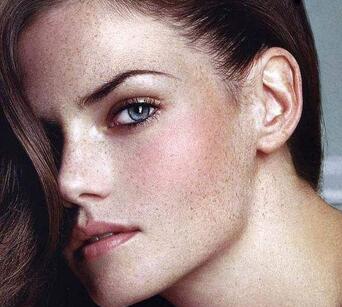 治疗雀斑有效的方法,目前治疗雀斑最有效的方法