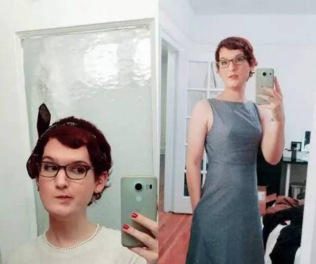 男人服用大量雄性激素会怎么样,男生长期服用雌性激素会怎么样