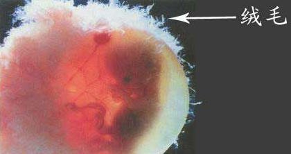 无创时代的产前筛查与产前诊断 (无创dna产前筛查)