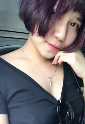 韩式三点双眼皮恢复单眼皮,韩式三点式双眼皮是永久性的吗