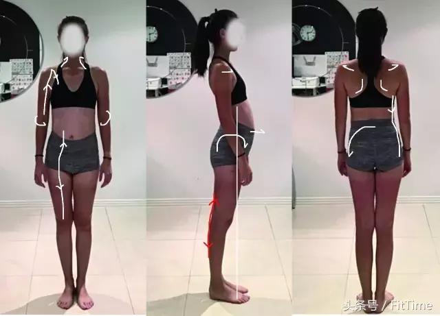 粗小腿怎么变细,粗小腿改善