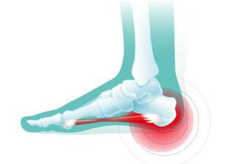 脚后跟疼的各种锻炼方法,脚后跟疼怎么做按摩