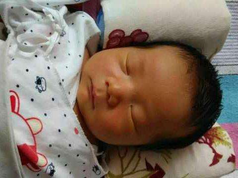 abo溶血性黄疸严重的话需要换血吗,新生儿黄疸400换血后会有什么反应