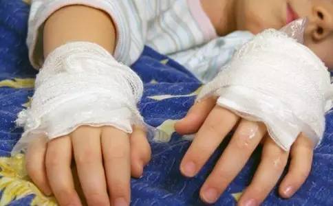 小儿骨折的危害有哪些,小儿骨折不愈合怎么处理