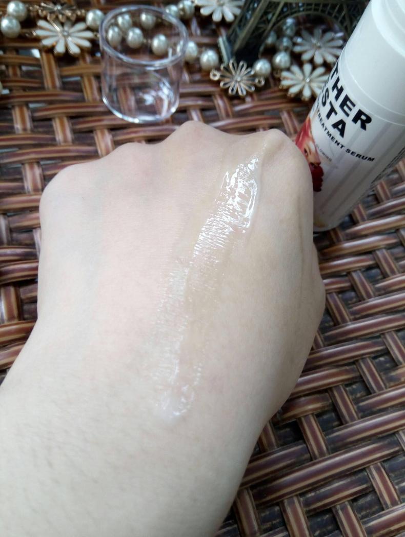 皮肤黄干性怎么护肤最好,皮肤黄有斑用什么护肤