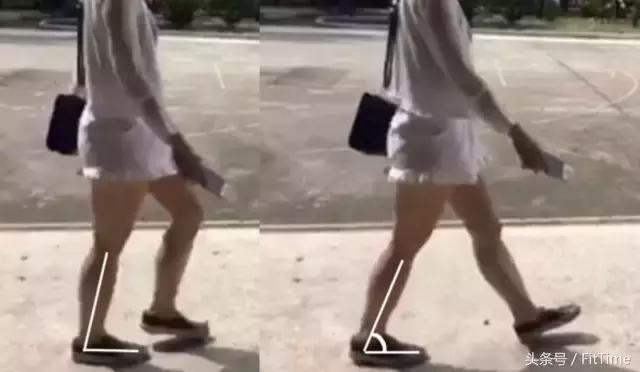 粗小腿怎么变细,粗小腿改善