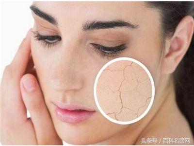 湿气会引起皮肤干燥粗糙吗,体内湿气重皮肤却很干中医辨证